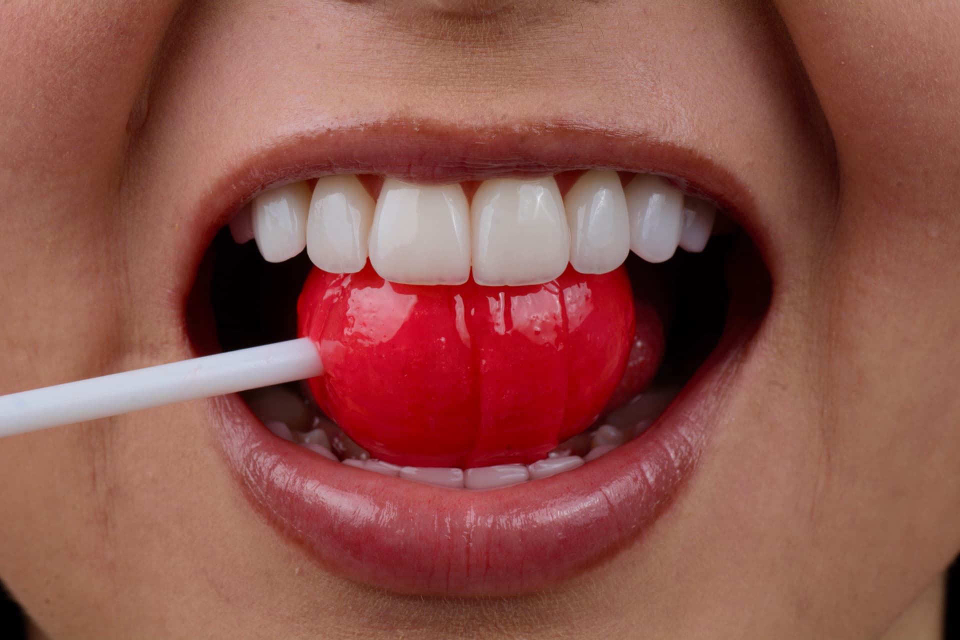Caso real de diseño de sonrisa